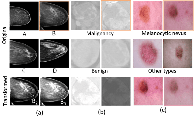 Figure 3 for Medical Knowledge-Guided Deep Learning for Imbalanced Medical Image Classification