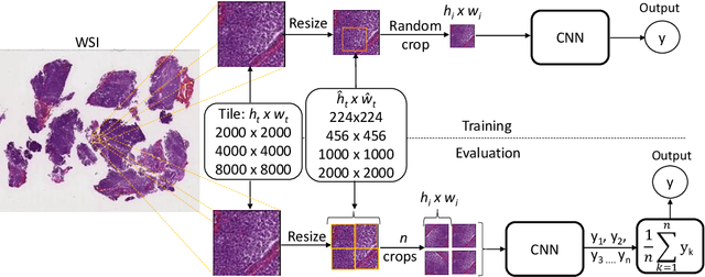 Figure 1 for Multi-Scale Input Strategies for Medulloblastoma Tumor Classification using Deep Transfer Learning