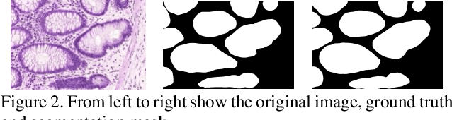 Figure 3 for Gland Segmentation in Histopathology Images Using Deep Networks and Handcrafted Features