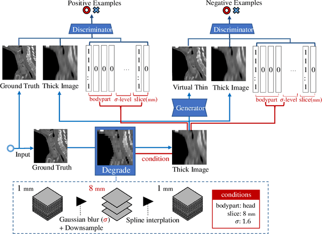 Figure 3 for Virtual Thin Slice: 3D Conditional GAN-based Super-resolution for CT Slice Interval