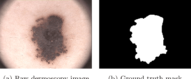 Figure 1 for MFSNet: A Multi Focus Segmentation Network for Skin Lesion Segmentation