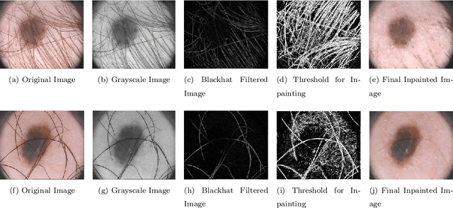 Figure 3 for MFSNet: A Multi Focus Segmentation Network for Skin Lesion Segmentation