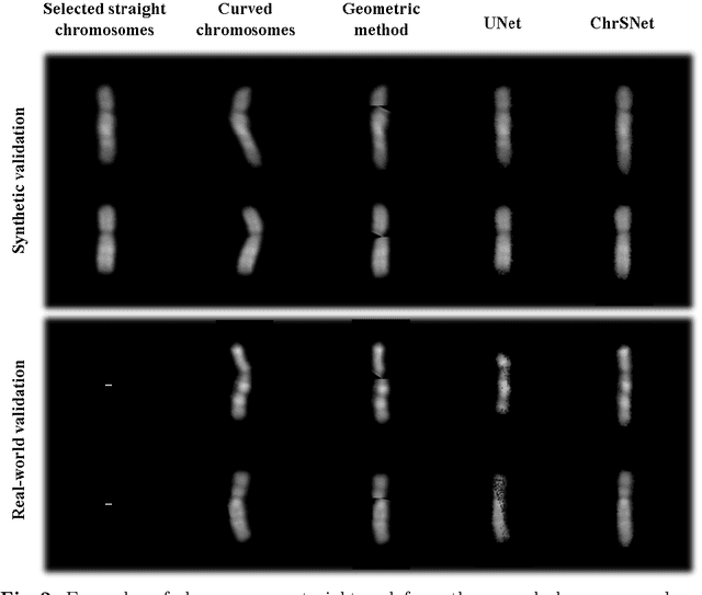 Figure 3 for ChrSNet: Chromosome Straightening using Self-attention Guided Networks