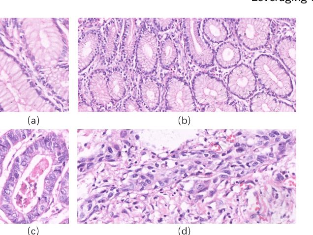 Figure 3 for A New Gastric Histopathology Subsize Image Database (GasHisSDB) for Classification Algorithm Test: from Linear Regression to Visual Transformer
