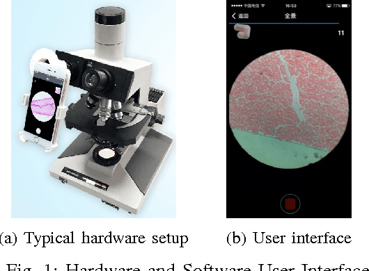 Figure 1 for sWSI: A Low-cost and Commercial-quality Whole Slide Imaging System on Android and iOS Smartphones
