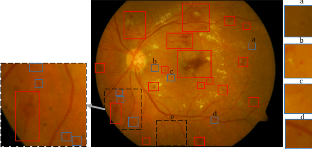 Figure 1 for A Deep Learning-Based Unified Framework for Red Lesions Detection on Retinal Fundus Images