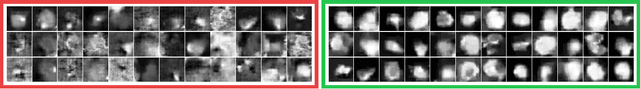 Figure 2 for How to Fool Radiologists with Generative Adversarial Networks? A Visual Turing Test for Lung Cancer Diagnosis
