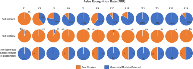 Figure 4 for How to Fool Radiologists with Generative Adversarial Networks? A Visual Turing Test for Lung Cancer Diagnosis