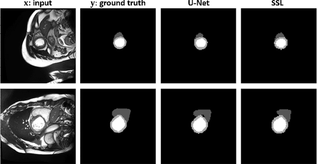 Figure 2 for Segmentation of Cardiac Structures via Successive Subspace Learning with Saab Transform from Cine MRI