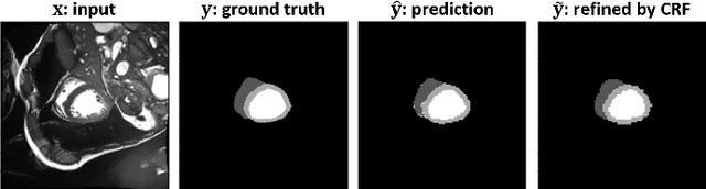 Figure 4 for Segmentation of Cardiac Structures via Successive Subspace Learning with Saab Transform from Cine MRI