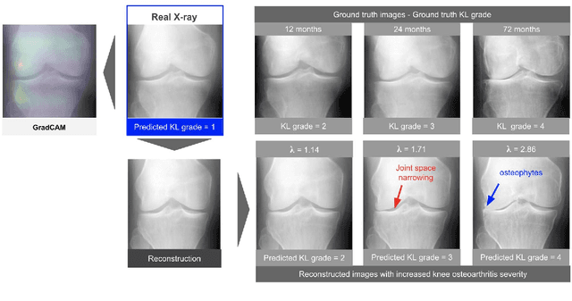 Figure 1 for Using StyleGAN for Visual Interpretability of Deep Learning Models on Medical Images