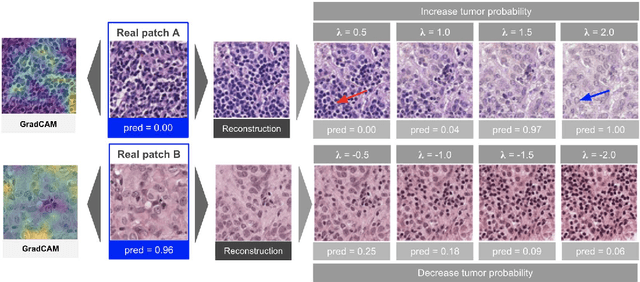 Figure 2 for Using StyleGAN for Visual Interpretability of Deep Learning Models on Medical Images