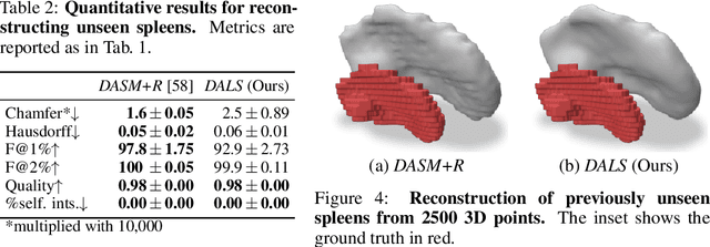 Figure 4 for Deep Active Latent Surfaces for Medical Geometries