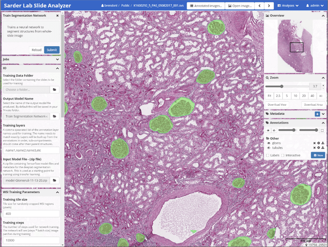 Figure 2 for A tool for user friendly, cloud based, whole slide image segmentation