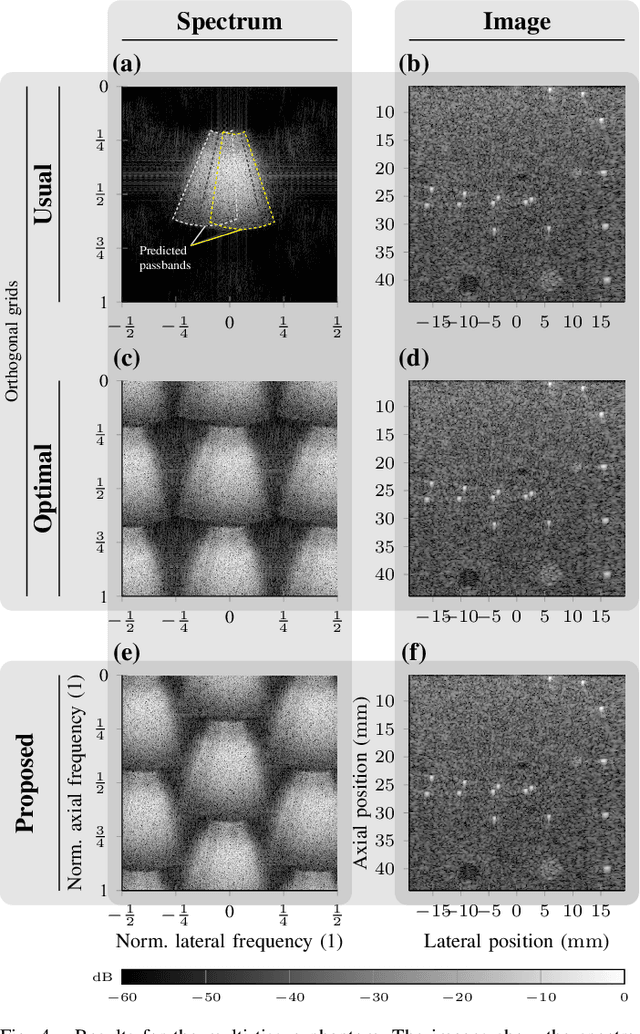 Figure 4 for Rhombic Grids Reduce the Number of Voxels in Fast Pulse-Echo Ultrasound Imaging