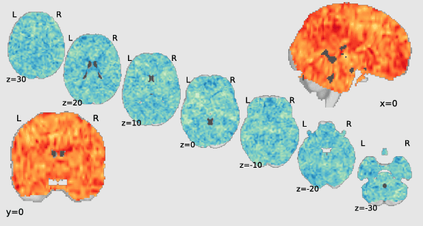 Figure 1 for Sturm: Sparse Tubal-Regularized Multilinear Regression for fMRI