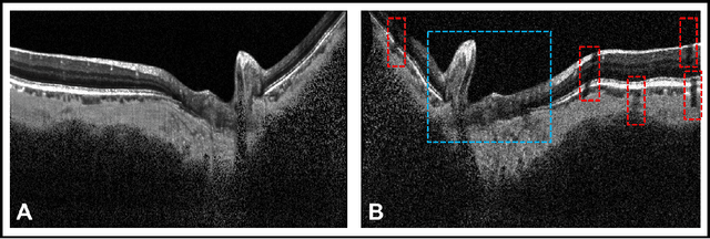 Figure 3 for DRUNET: A Dilated-Residual U-Net Deep Learning Network to Digitally Stain Optic Nerve Head Tissues in Optical Coherence Tomography Images