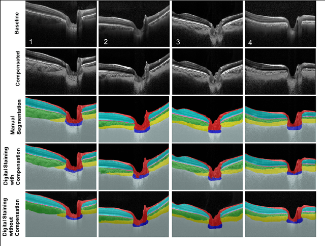Figure 4 for DRUNET: A Dilated-Residual U-Net Deep Learning Network to Digitally Stain Optic Nerve Head Tissues in Optical Coherence Tomography Images