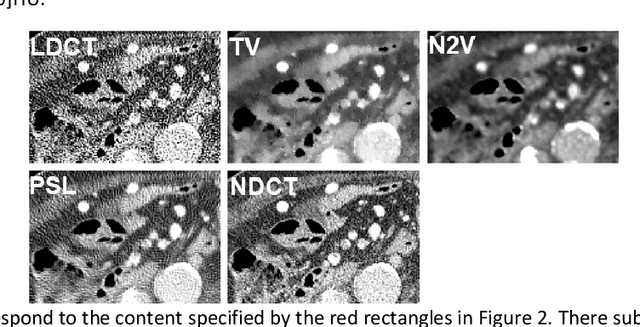 Figure 3 for Probabilistic self-learning framework for Low-dose CT Denoising