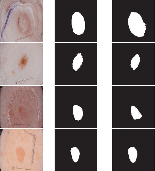 Figure 3 for FocusNet: An attention-based Fully Convolutional Network for Medical Image Segmentation