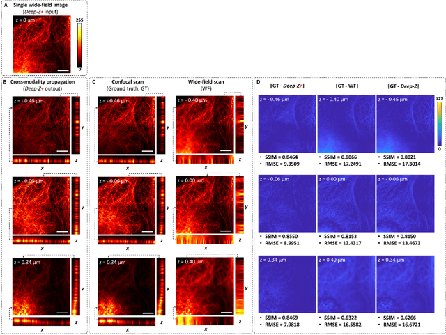 Figure 4 for Three-dimensional propagation and time-reversal of fluorescence images