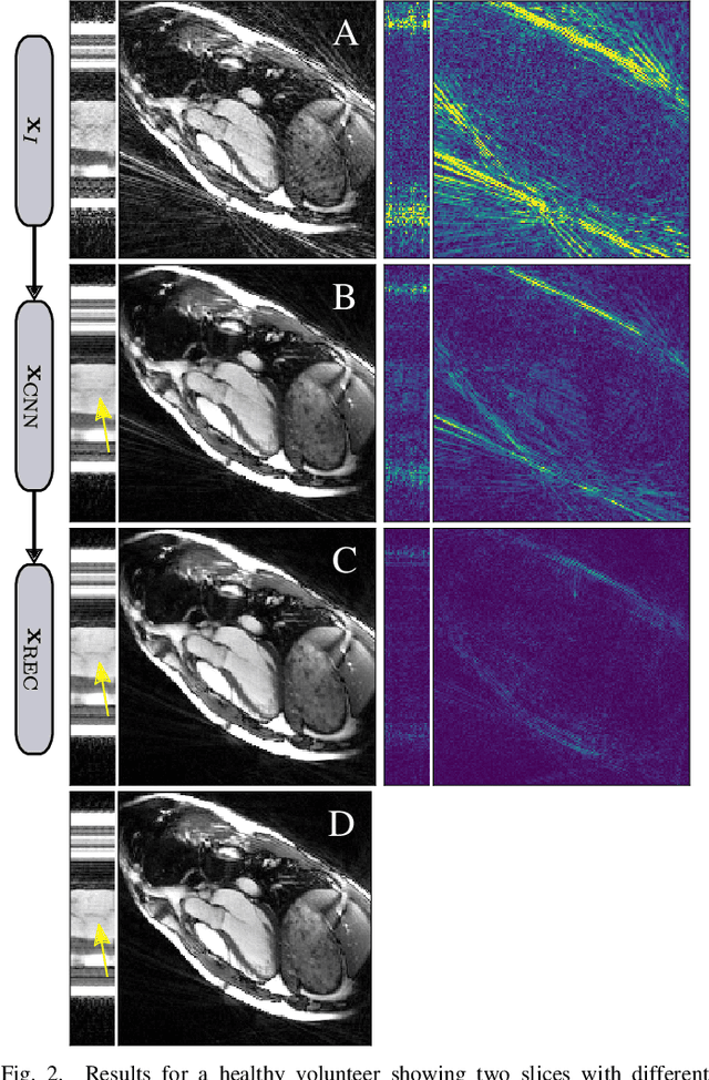 Figure 2 for Neural Networks-based Regularization for Large-Scale Medical Image Reconstruction