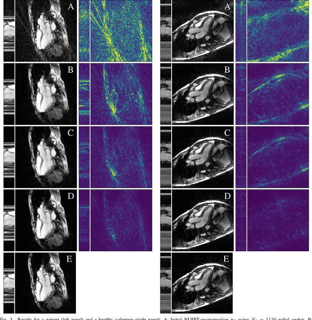 Figure 3 for Neural Networks-based Regularization of Large-Scale Inverse Problems in Medical Imaging