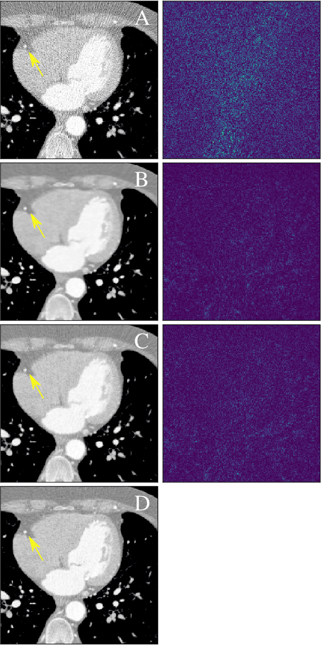 Figure 4 for Neural Networks-based Regularization for Large-Scale Medical Image Reconstruction