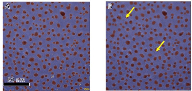 Figure 1 for Understanding Important Features of Deep Learning Models for Transmission Electron Microscopy Image Segmentation