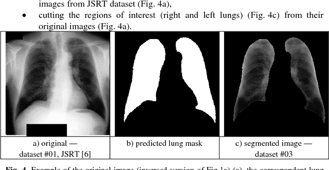 Figure 4 for Deep Learning with Lung Segmentation and Bone Shadow Exclusion Techniques for Chest X-Ray Analysis of Lung Cancer