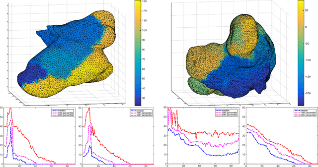 Figure 4 for Computer Assisted Localization of a Heart Arrhythmia