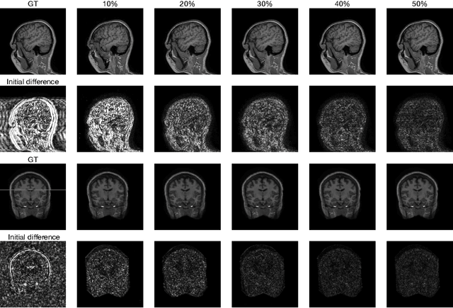 Figure 4 for Deep De-Aliasing for Fast Compressive Sensing MRI