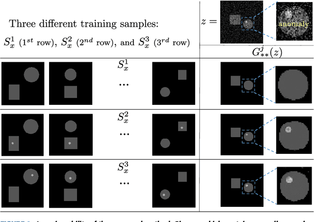 Figure 1 for Unpaired image denoising using a generative adversarial network in X-ray CT