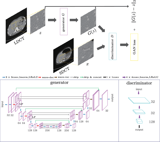 Figure 4 for Unpaired image denoising using a generative adversarial network in X-ray CT