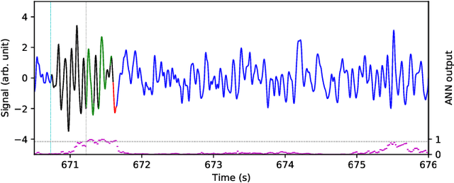 Figure 3 for The Portiloop: a deep learning-based open science tool for closed-loop brain stimulation