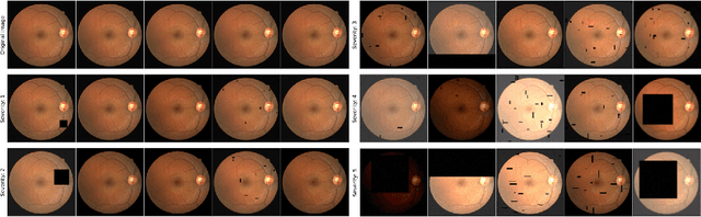 Figure 3 for Robust and efficient computation of retinal fractal dimension through deep approximation