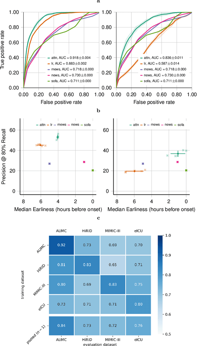 Figure 4 for Predicting sepsis in multi-site, multi-national intensive care cohorts using deep learning