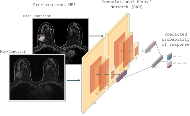 Figure 3 for Deep learning-based prediction of response to HER2-targeted neoadjuvant chemotherapy from pre-treatment dynamic breast MRI: A multi-institutional validation study