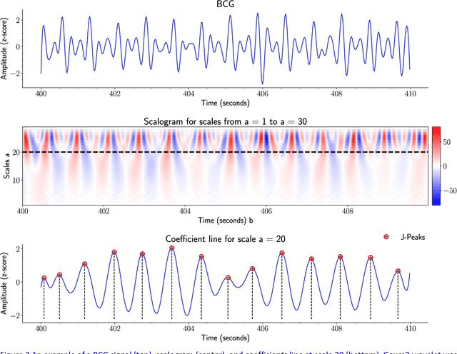 Figure 3 for A comparison of three heart rate detection algorithms over ballistocardiogram signals