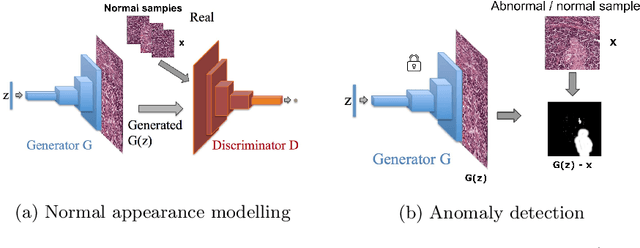 Figure 1 for Image Synthesis as a Pretext for Unsupervised Histopathological Diagnosis