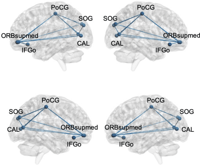 Figure 3 for Early Disease Stage Characterization in Parkinson's Disease from Resting-state fMRI Data Using a Long Short-term Memory Network