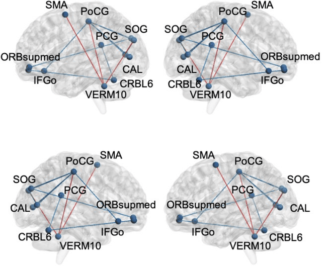 Figure 4 for Early Disease Stage Characterization in Parkinson's Disease from Resting-state fMRI Data Using a Long Short-term Memory Network
