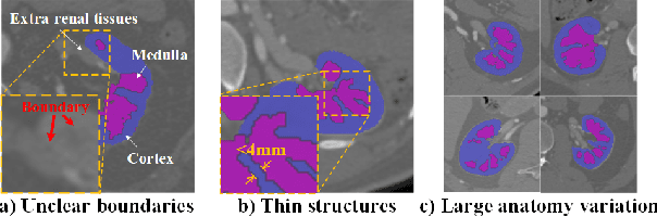 Figure 1 for CPNet: Cycle Prototype Network for Weakly-supervised 3D Renal Compartments Segmentation on CT Images
