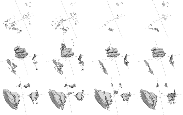 Figure 2 for Towards Deep Learning-assisted Quantification of Inflammation in Spondyloarthritis: Intensity-based Lesion Segmentation