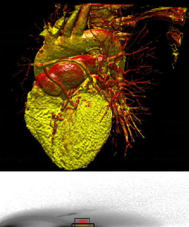Figure 2 for Neural networks in 3D medical scan visualization