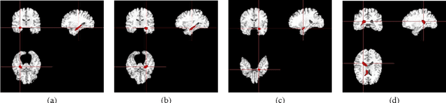Figure 3 for Multiple Kernel Learning in the Primal for Multi-modal Alzheimer's Disease Classification