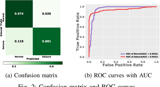 Figure 2 for Adversarial Representation Learning for Robust Patient-Independent Epileptic Seizure Detection