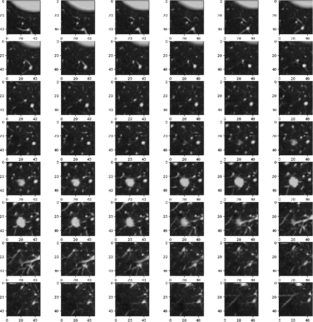 Figure 1 for Deep 3D Convolutional Neural Network for Automated Lung Cancer Diagnosis