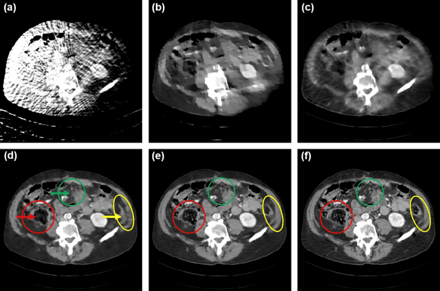 Figure 4 for AI-Enabled Ultra-Low-Dose CT Reconstruction