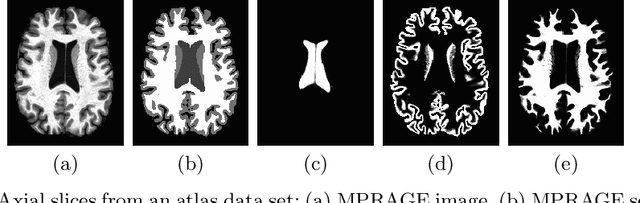 Figure 3 for Contrast Adaptive Tissue Classification by Alternating Segmentation and Synthesis